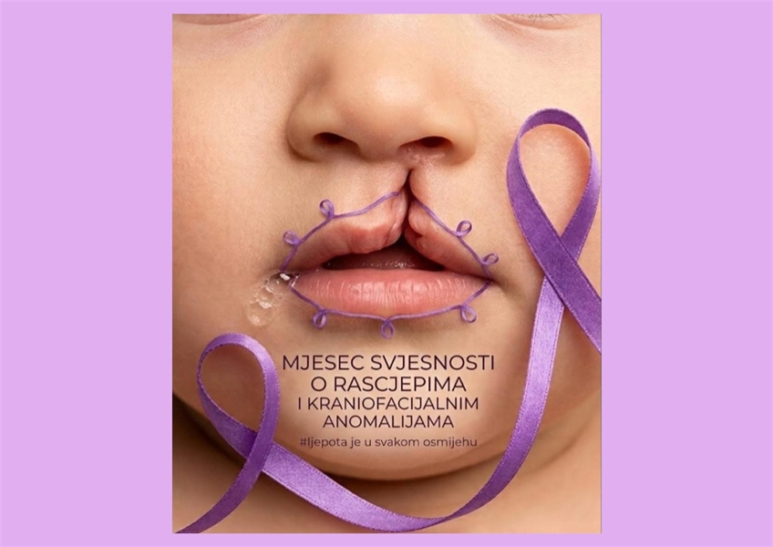 Srpanj - mjesec svjesnosti o rascjepima usne i nepca