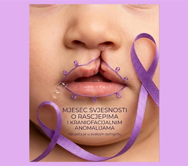 Srpanj - mjesec svjesnosti o rascjepima usne i nepca