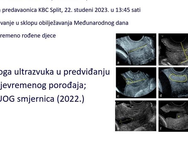 Stručni sastanak na temu „Uloga ultrazvuka u predviđanju prijevremenog porođaja; ISUOG smjernica (2022.)“.