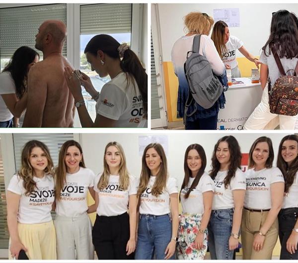 Održana preventivna akcija pregleda kože i madeža