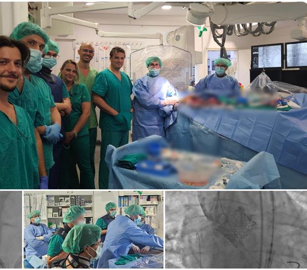 Klinika za bolesti srca i krvnih žila: nova procedura transkavalnog pristupa za transkatetersku ugradnju aortnog zalistka