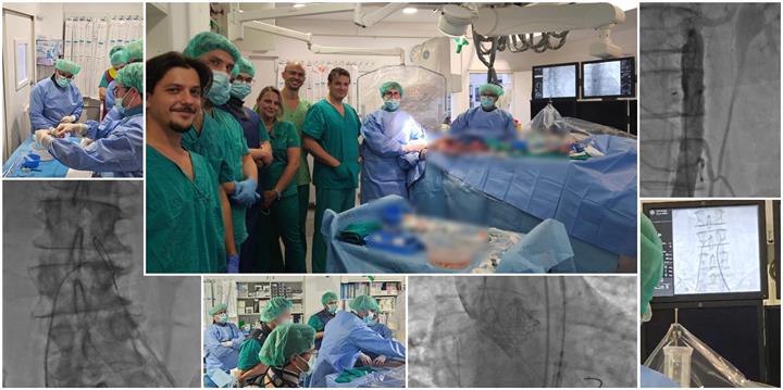 Klinika za bolesti srca i krvnih žila: nova procedura transkavalnog pristupa za transkatetersku ugradnju aortnog zalistka