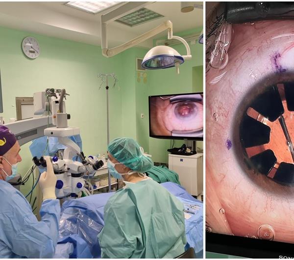 Klinika za očne bolesti KBC-a Split: Prvi put implantirana umjetna šarenica pacijentici koja je rođena bez nje