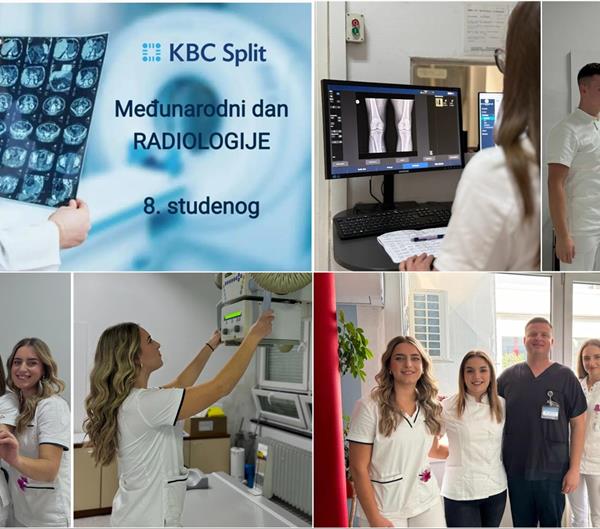 Međunarodni dan radiologije: Zajednička akcija Fakulteta zdravstvenih znanosti Sveučilišta u Splitu i KBC-a Split
