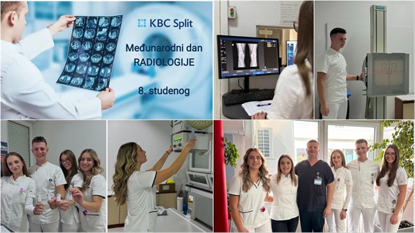 Međunarodni dan radiologije: Zajednička akcija Fakulteta zdravstvenih znanosti Sveučilišta u Splitu i KBC-a Split