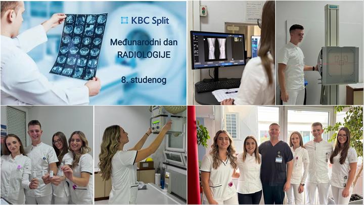 Međunarodni dan radiologije: Zajednička akcija Fakulteta zdravstvenih znanosti Sveučilišta u Splitu i KBC-a Split