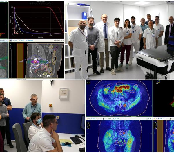 U KBC-u Split započeli s primjenom stereotaksijske radioterapije, poznatije kao radiokirurgija linearnim akceleratorom