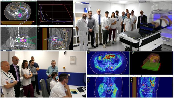 U KBC-u Split započeli s primjenom stereotaksijske radioterapije, poznatije kao radiokirurgija linearnim akceleratorom