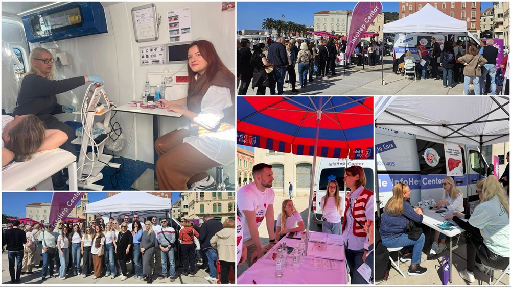 Svjetski dan jetre: Javnozdravstvena akcija „Brini o jetri danas – spriječi rak sutra“